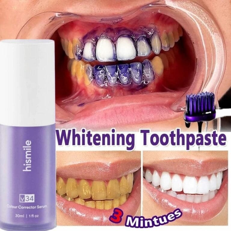 Hismile V34 Color Corrector Serum | High Quality |  Instant Teeth Brightening Solution | 30ml - View 2